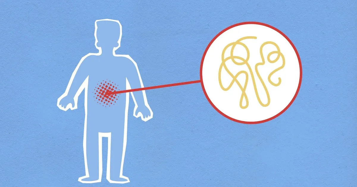 Article featured image